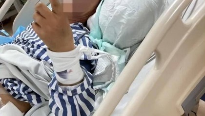 拔牙进了ICU！福州男子险没命！医生紧急提醒