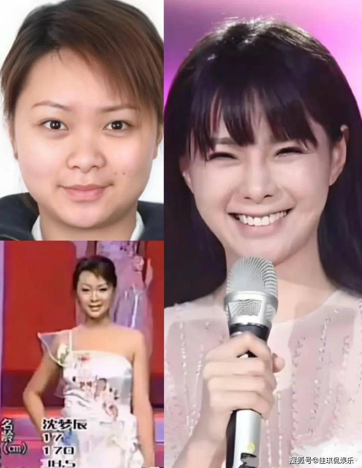 收手吧！金晨直播大变脸，嘴歪之后鼻子也歪了，又要返厂维修了
