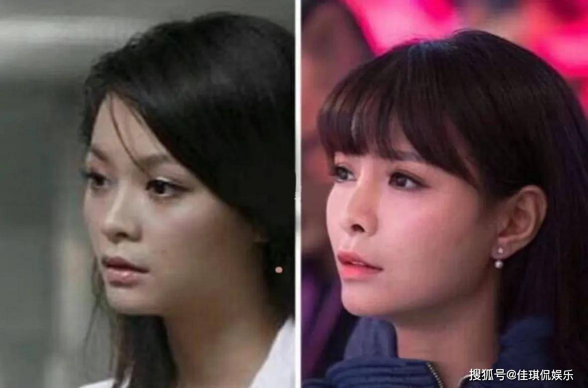 收手吧！金晨直播大变脸，嘴歪之后鼻子也歪了，又要返厂维修了